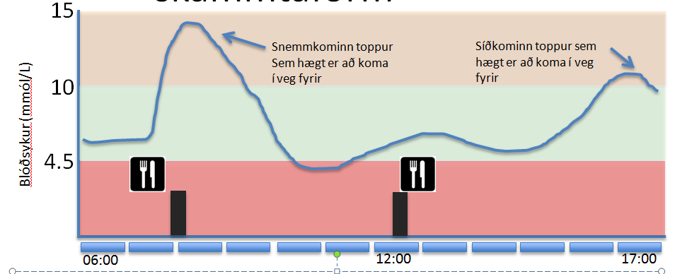 Að tímasetja máltíðarinsúlín og velja skammtaform